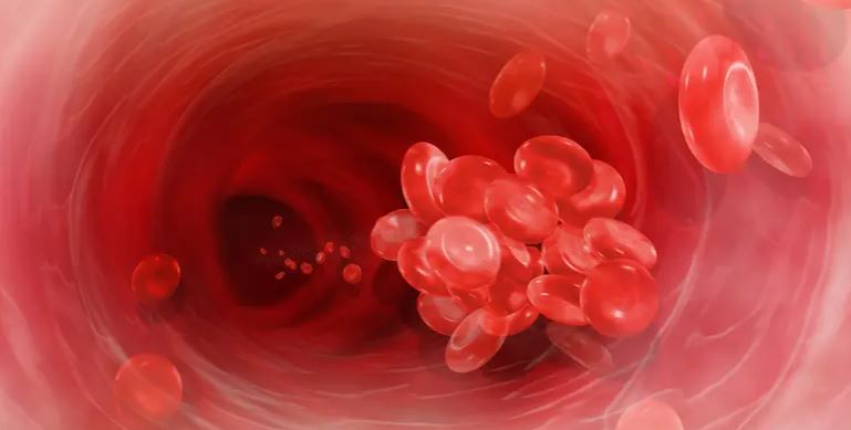 بينها الخبز الأبيض.. 5 أطعمة يمكن أن تسبب جلطات دموية خطيرة