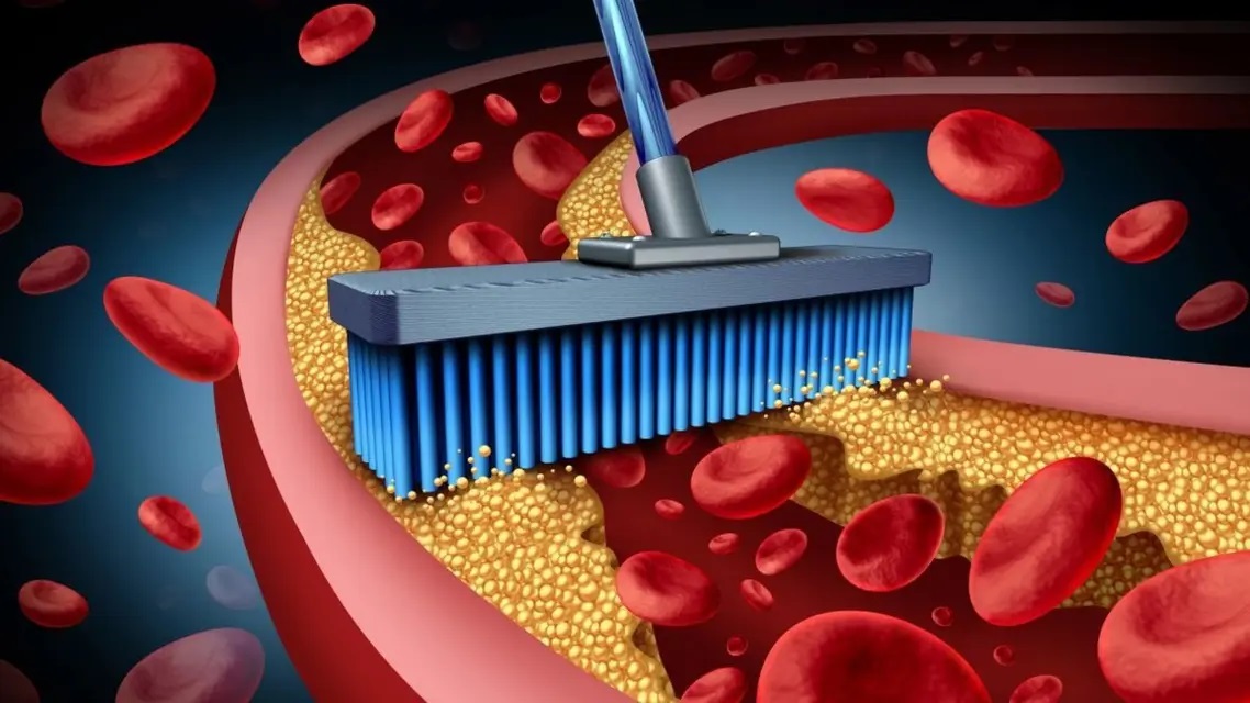 إحذروا هذه العلامات الخطرة فهي دليل الإصابة بالكوليستيرول